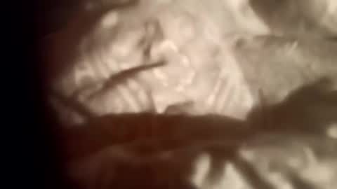 moos1 online show from 02/28/26, 09:05